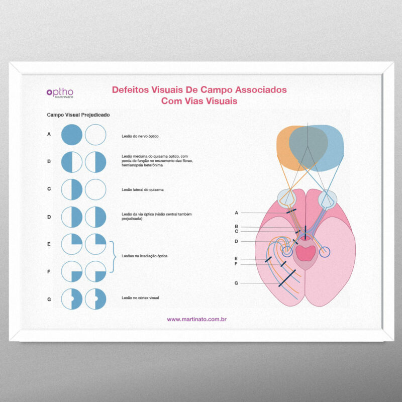 defeitos visuais martinato