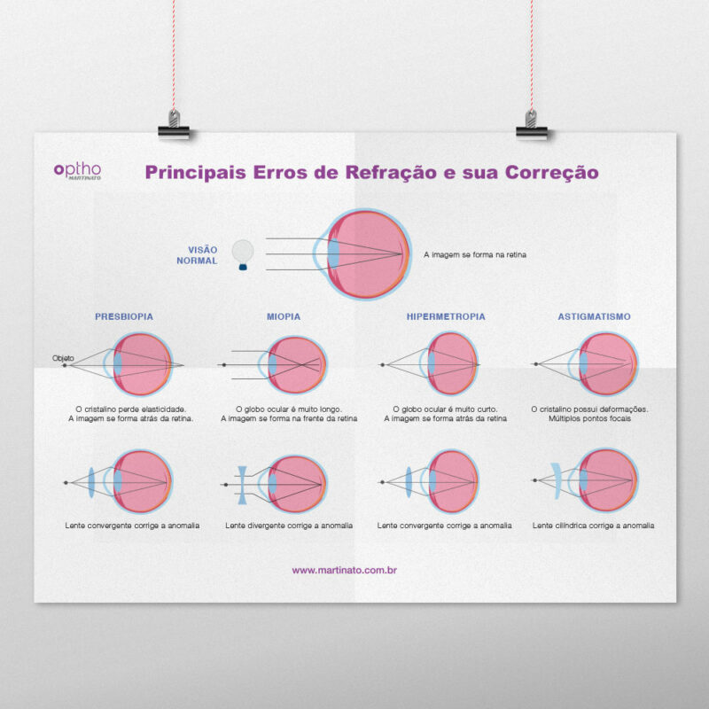 Poster Erros de Refração
