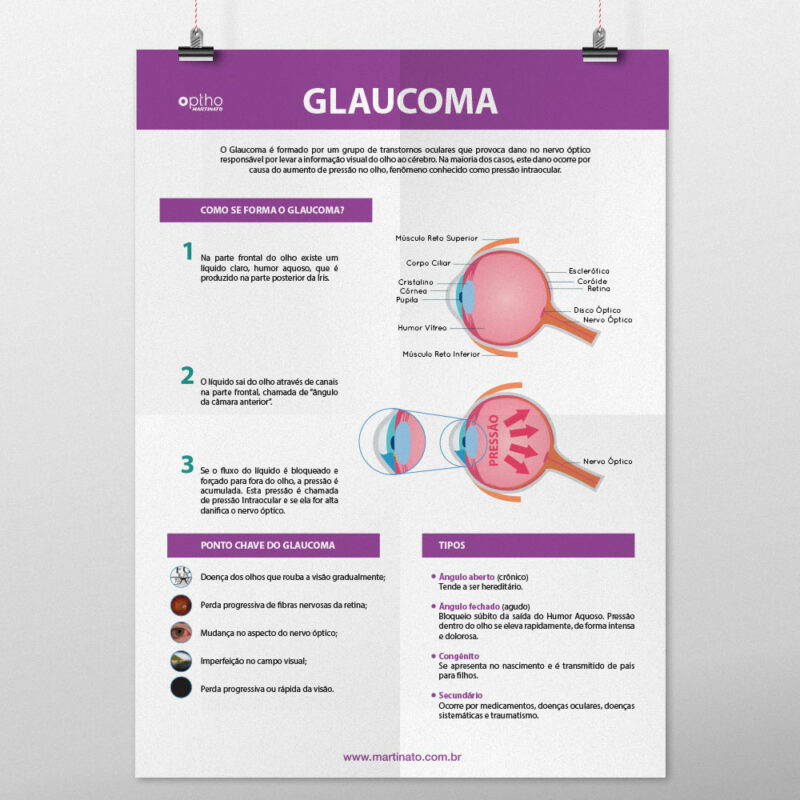 Poster Glaucoma