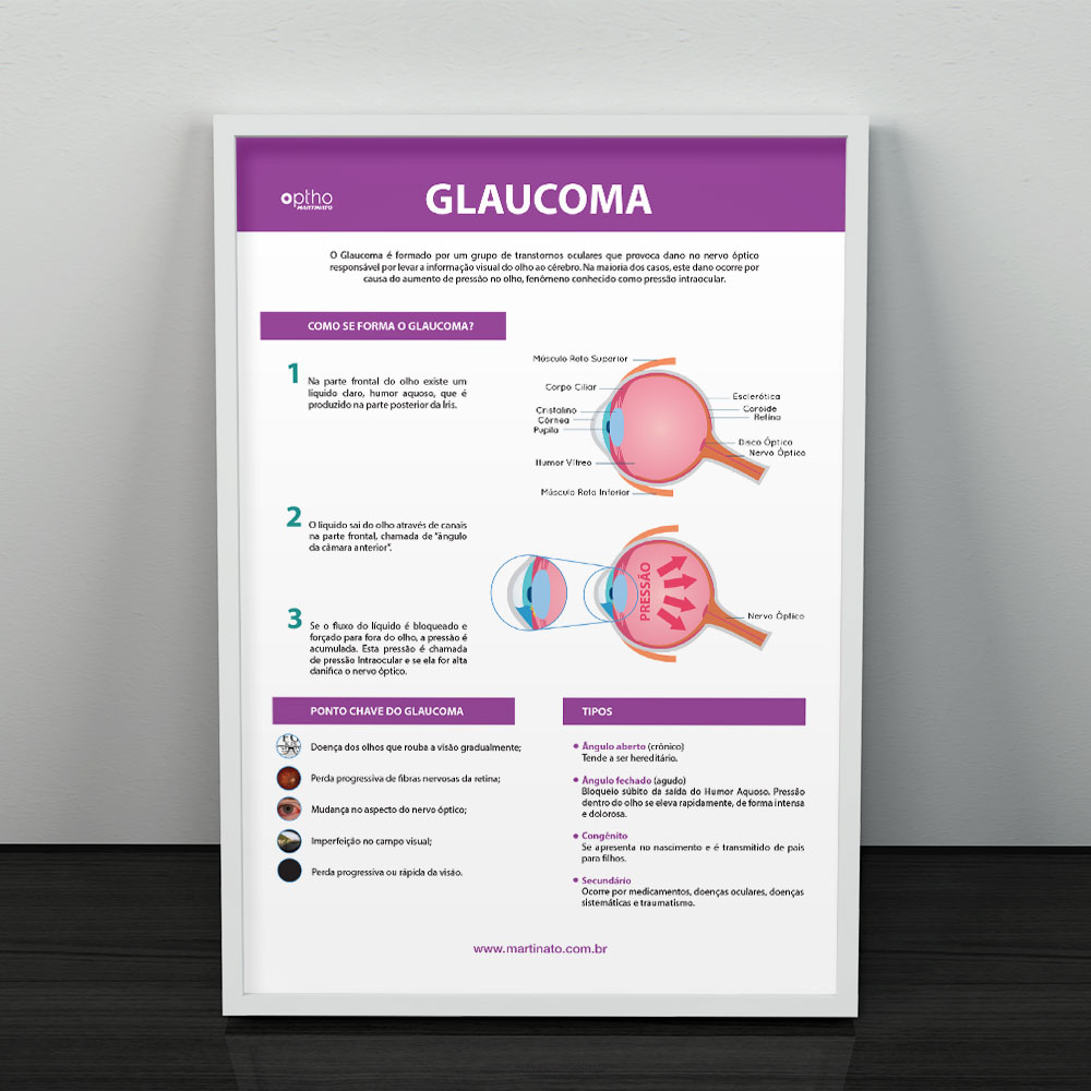 glaucoma-martinato