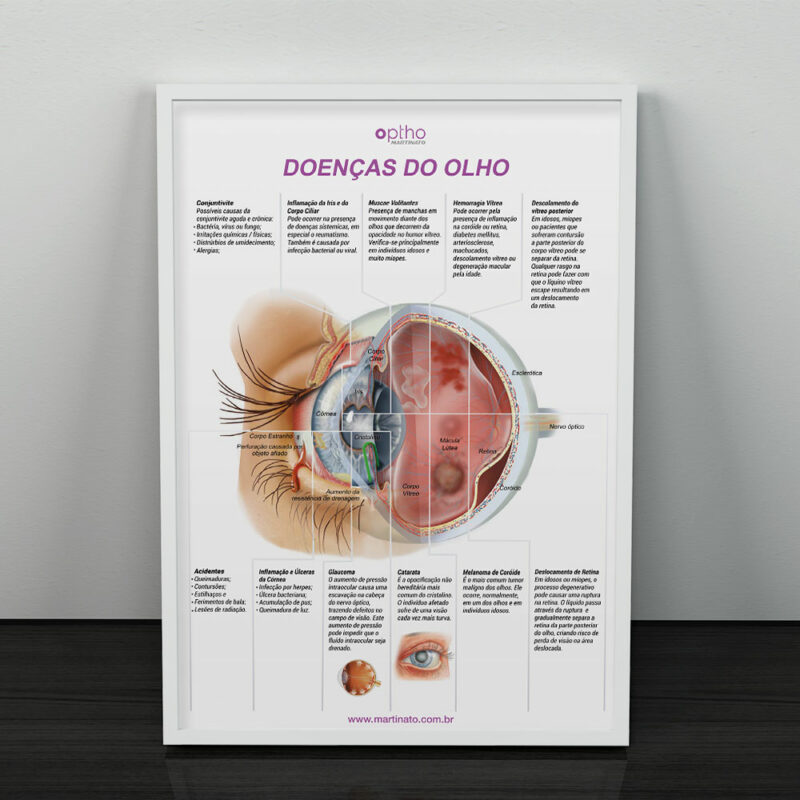 Doenças do Olho II com Moldura