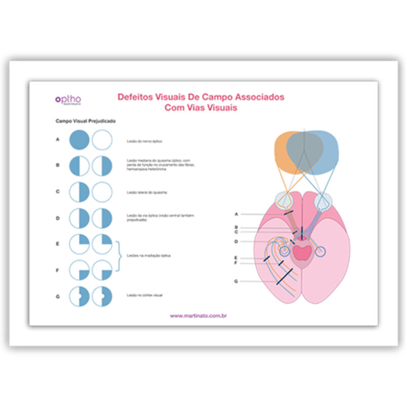 quadro defeitos visuais martinato decoração-consultorio