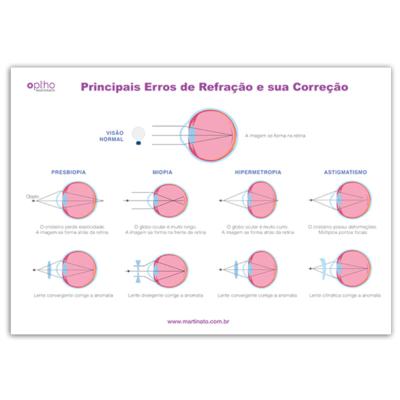 Poster refração martinato decoração para consultório oftalmo