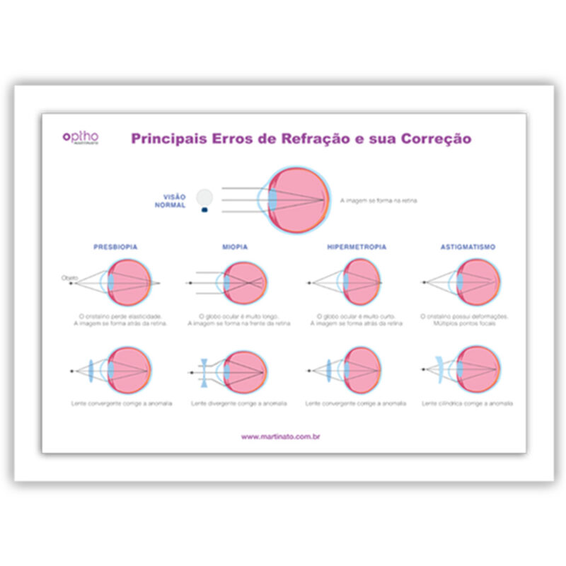 Poster refração martinato decoração consultório