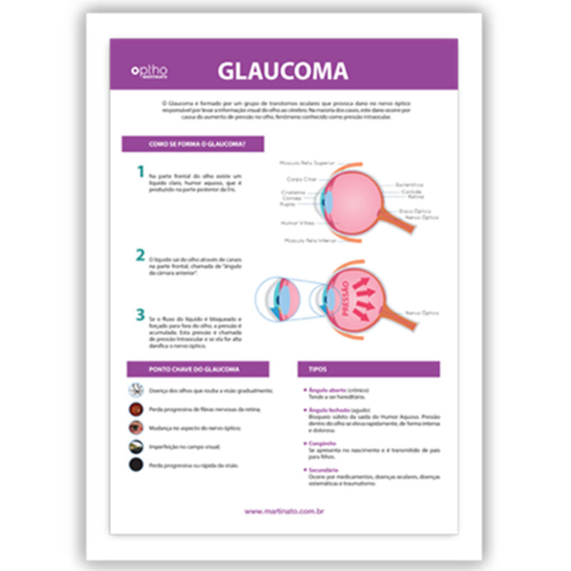 Poster glaucoma martinato decoração consultório oftalmo