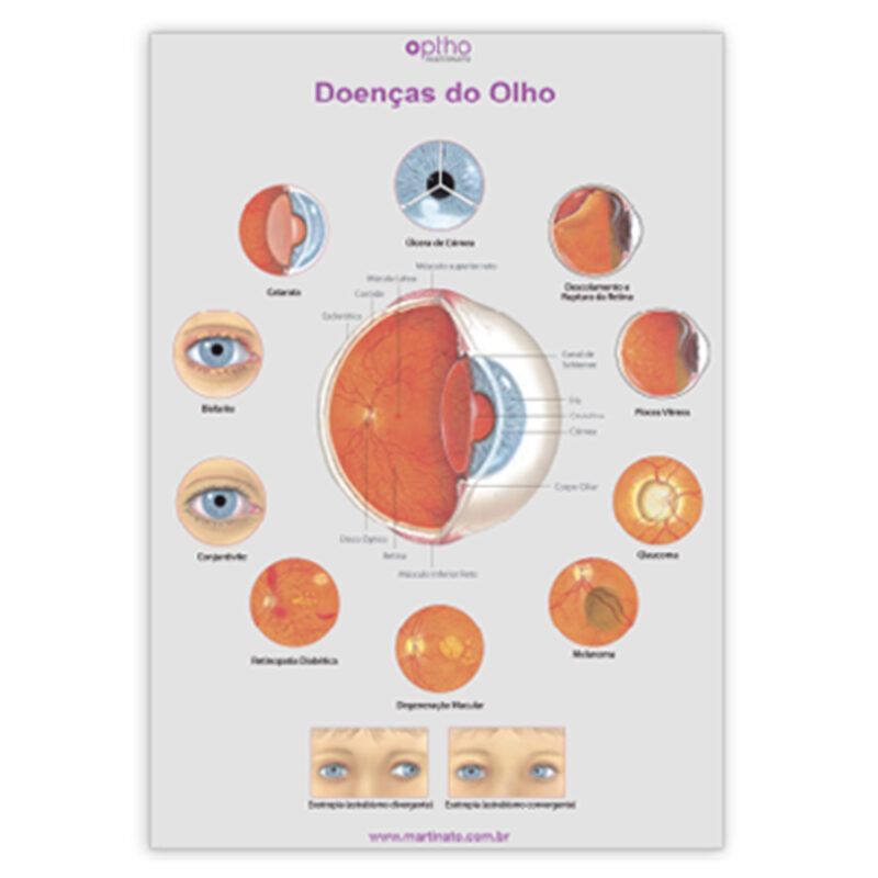 Poster doencas do olho martinato decoração consultorio oftalmo