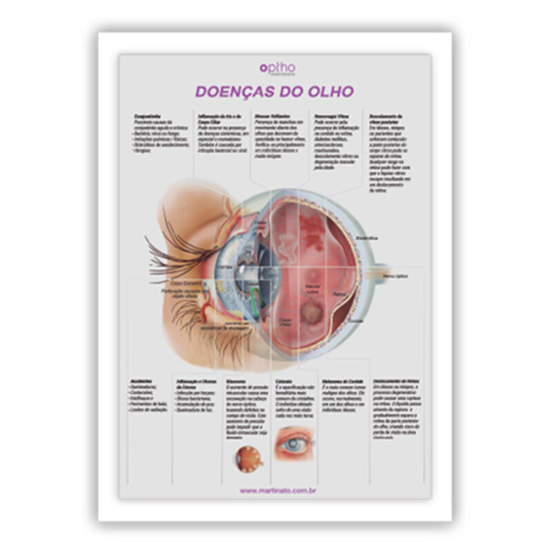 Poster doencas-do-olho-ii-com-moldura-martinato-quadro