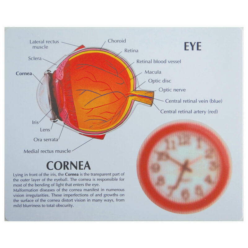 lm-301e-olho-humano-cornea-martinato