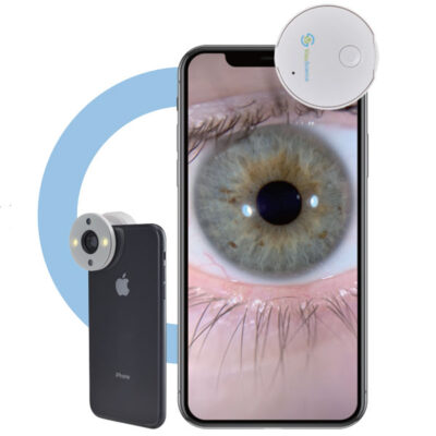 Alternative view of QuikVue: Fotografia Ocular