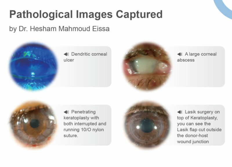 QuikVue: Fotografia Ocular - Image 3